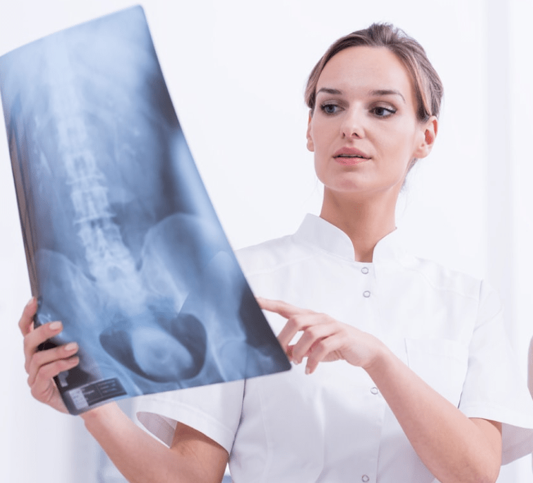 Krūškurvja osteohondrozes diagnostika ar rentgena pārbaudi